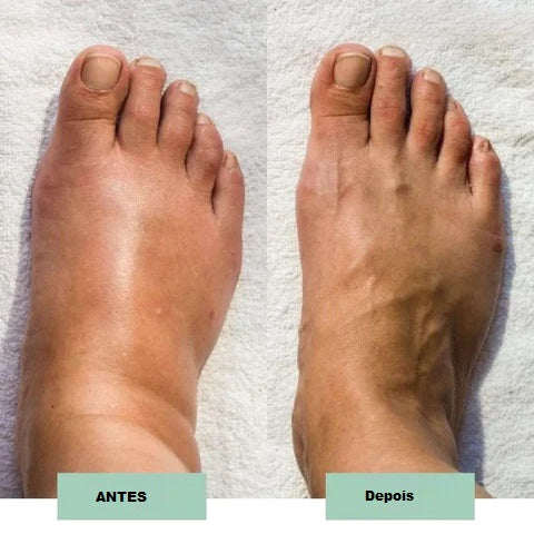 massageador de pés - ProFoot™
