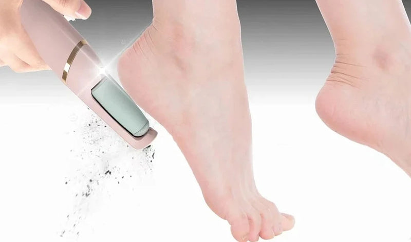 Removedor De Calos - Lixa Elétrica de Calos e Rachadura EcoVolt