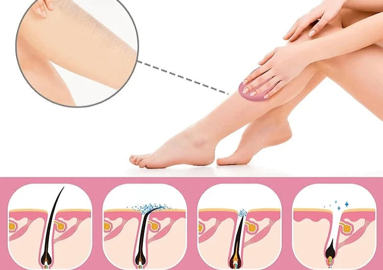 Depilador de borracha para  cabelo de cristal🔥Lumière Chic