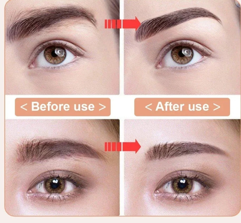 Caneta de remoção de pêlos